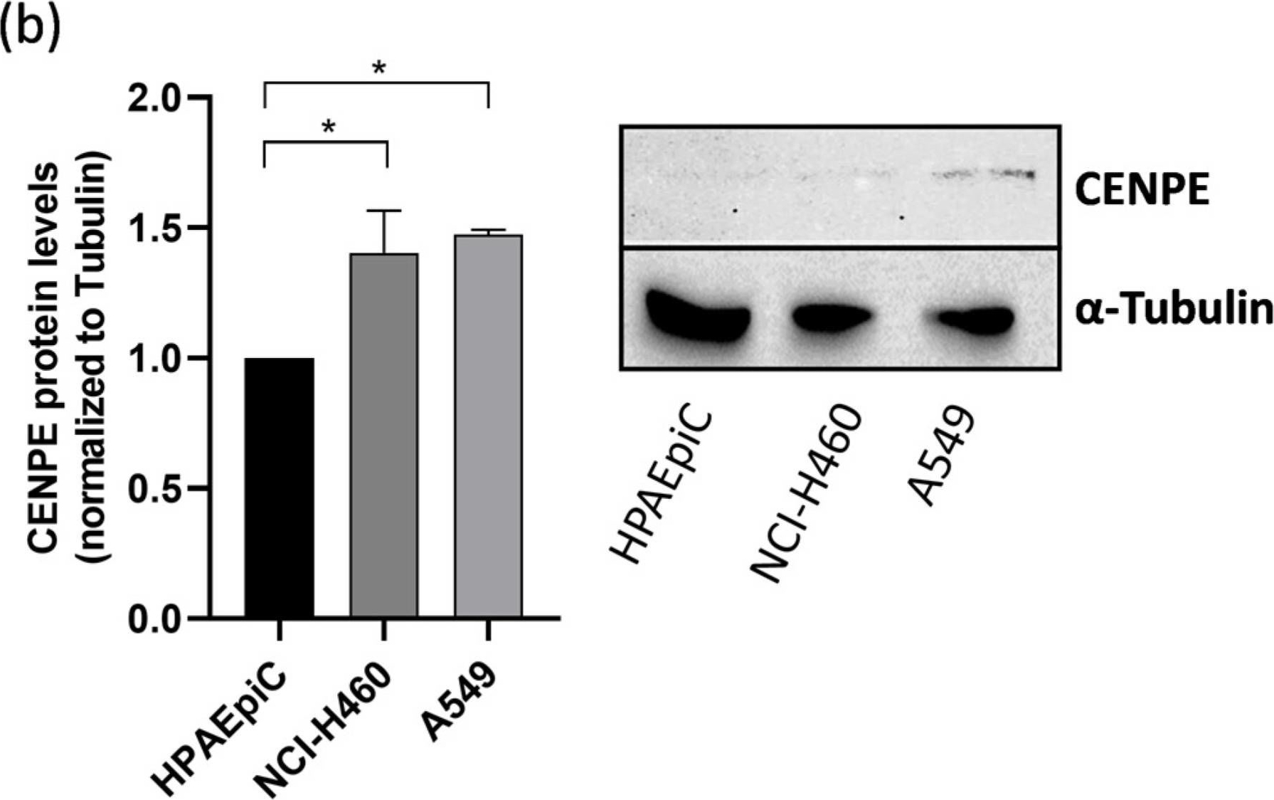 Fig.1.B showing Western Blotting in an Armoracia rusticana (Horseradish) sample from the publication: Maximizing Anticancer Response with MPS1 and CENPE Inhibition Alongside Apoptosis Induction.