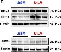 Fig.1.D showing Western Blotting from the publication: Decoding Bromodomain and Extra-Terminal Domain Protein-Mediated Epigenetic Mechanisms in Human Uterine Fibroids.