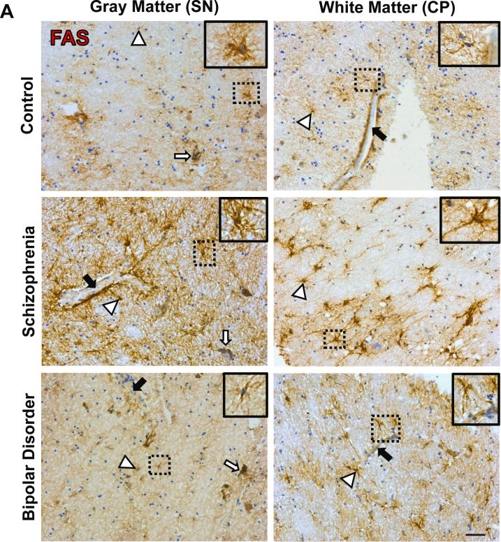 Fig.5.A showing Immunohistochemistry in a Homo sapiens (Human) sample from the publication: Increased Tumor Necrosis Factor Superfamily Members in Neuroinflammatory Schizophrenia and Bipolar Disorder Midbrains.