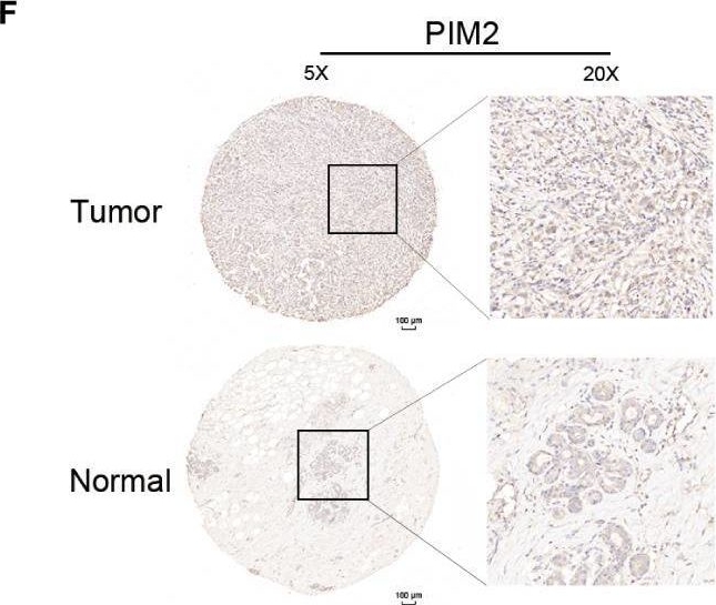 Pim2 PIM2 antibodies - Antibody search engine - CiteAb