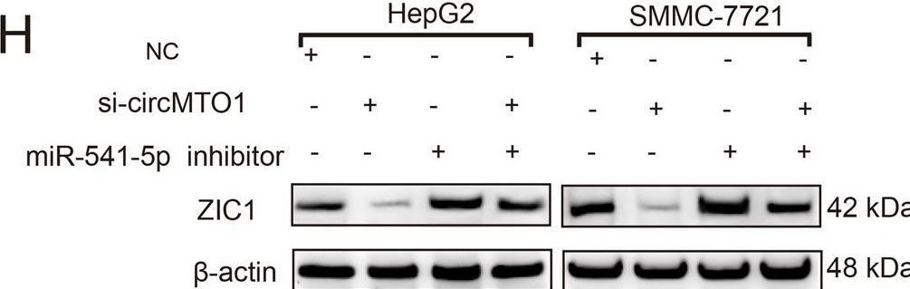 Fig.5.H showing Western Blotting in a Homo sapiens (Human) sample from the publication: CircMTO1 suppresses hepatocellular carcinoma progression via the miR-541-5p/ZIC1 axis by regulating Wnt/β-catenin signaling pathway and epithelial-to-mesenchymal transition.