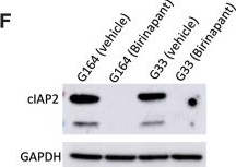 Fig.2.F showing Western Blotting in a Homo sapiens (Human) sample from the publication: Human 3D Ovarian Cancer Models Reveal Malignant Cell-Intrinsic and -Extrinsic Factors That Influence CAR T-cell Activity.