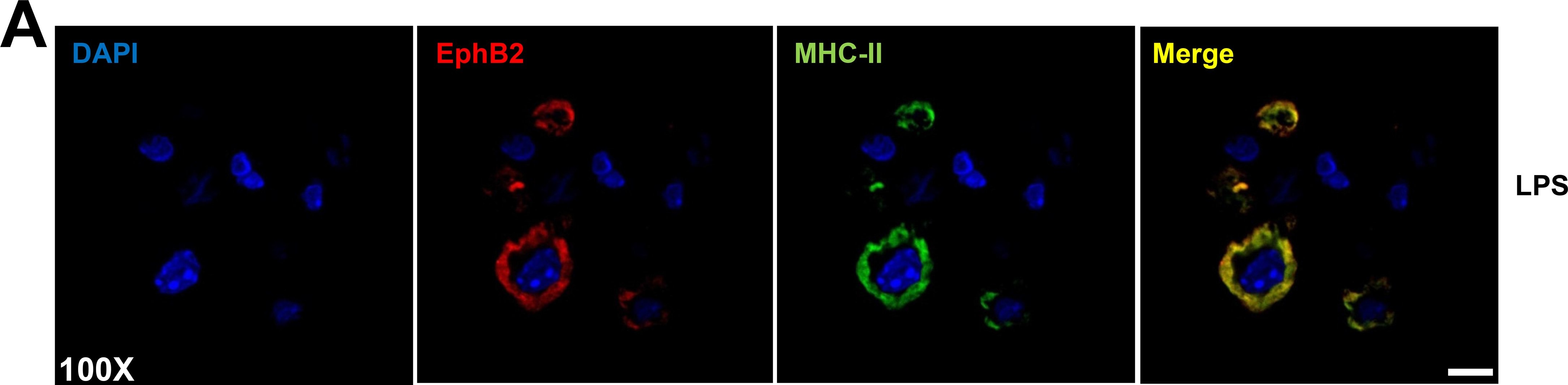 Fig.5.A showing Immunocytochemistry-immunofluorescence in a Mus musculus (House mouse) sample from the publication: Expression of the Receptor Tyrosine Kinase EphB2 on Dendritic Cells Is Modulated by Toll-Like Receptor Ligation but Is Not Required for T Cell Activation.