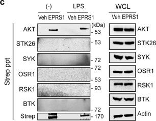 Fig.2.C showing Western Blotting in a Homo sapiens (Human) sample from the publication: Glutamyl-prolyl-tRNA synthetase 1 coordinates early endosomal anti-inflammatory AKT signaling.