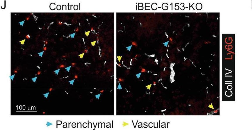 Fig.9.J showing Immunohistochemistry-frozen immunofluorescence in a Mus musculus (House mouse) sample from the publication: Orphan receptor GPR153 facilitates vascular damage responses by modulating cAMP levels, YAP/TAZ signaling, and NF-κB activation.