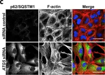 Fig.3.C showing Immunocytochemistry-immunofluorescence in a Homo sapiens (Human) sample from the publication: Autophagy inhibition-mediated epithelial-mesenchymal transition augments local myofibroblast differentiation in pulmonary fibrosis.