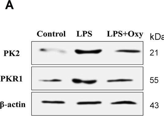 Fig.6.A showing Western Blotting in a Rattus norvegicus (Rat) sample from the publication: Oxytocin ameliorates lipopolysaccharide-induced acute orchitis model: interplay of oxidative stress and inflammatory pathways.