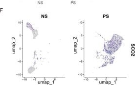 Fig.5.F showing Flow cytometry/Cell sorting from the publication: Bulk and Single-Cell Transcriptomics Reveal That SCO2 Drives Psoriasis via Activating CCR7+ Dendritic Cell.
