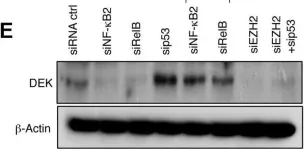 Fig.5.E showing Western Blotting from the publication: Regulation of p53 and Rb links the alternative NF-κB pathway to EZH2 expression and cell senescence.