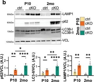 Schwann Cell-Specific Ablation of Beclin 1 Impairs Myelination and Leads to Motor and Sensory Neuropathy in Mice.