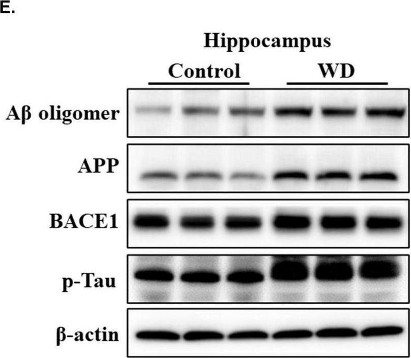 Fig.2.E showing Western Blotting from the publication: Western diet-induced visceral adipose tissue inflammation promotes Alzheimer's disease pathology via microglial activation in a mouse model.