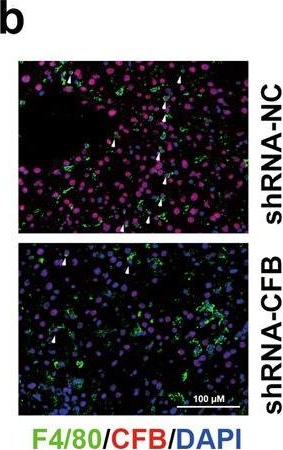 Fig.6.B showing Immunohistochemistry-immunofluorescence in a Mus musculus (House mouse) sample from the publication: Mechanistic target of rapamycin complex 1 orchestrates the interplay between hepatocytes and Kupffer cells to determine the outcome of immune-mediated hepatitis.