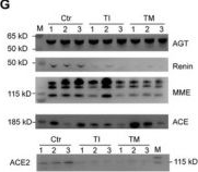 Fig.5.G showing Western Blotting in a Homo sapiens (Human) sample from the publication: Single-Position Peptide Clustering for Peptidomics Reveals Novel Disease Biomarkers and Dysregulated Proteolytic Characteristics.