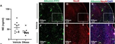 NeuN (D4G4O) XP® Rabbit mAb | Cell Signaling Technology