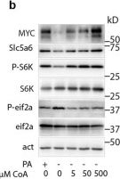 Fig.5.B showing Western Blotting in a Mus musculus (House mouse) sample from the publication: Vitamin B5 supports MYC oncogenic metabolism and tumor progression in breast cancer.