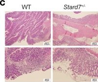 Fig.5.C showing Immunohistochemistry in a Mus musculus (House mouse) sample from the publication: STARD7 maintains intestinal epithelial mitochondria architecture, barrier integrity, and protection from colitis.