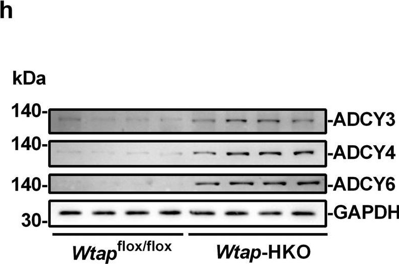 Fig.3.H showing Western Blotting in a Mus musculus (House mouse) sample from the publication: Deficiency of WTAP in hepatocytes induces lipoatrophy and non-alcoholic steatohepatitis (NASH).