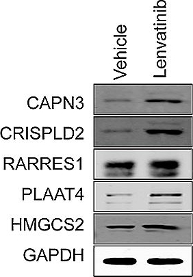 Fig.1.E showing Western Blotting in a Homo sapiens (Human) sample from the publication: RARRES1 inhibits hepatocellular carcinoma progression and increases its sensitivity to lenvatinib through interaction with SPINK2.