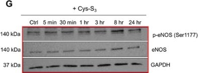 Fig.4.G showing Western Blotting in a Homo sapiens (Human) sample from the publication: Hydropersulfides promote angiogenesis and preserve vascular function.