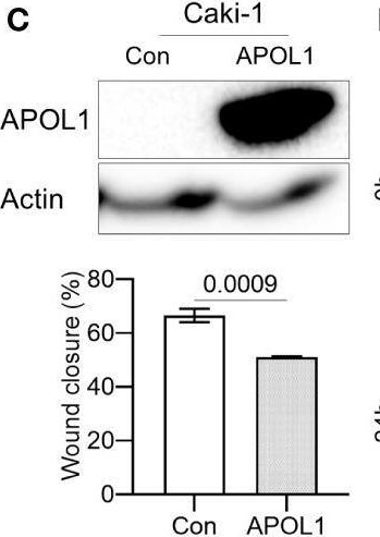 Fig.3.C showing Western Blotting from the publication: Apolipoprotein L1 is a tumor suppressor in clear cell renal cell carcinoma metastasis.