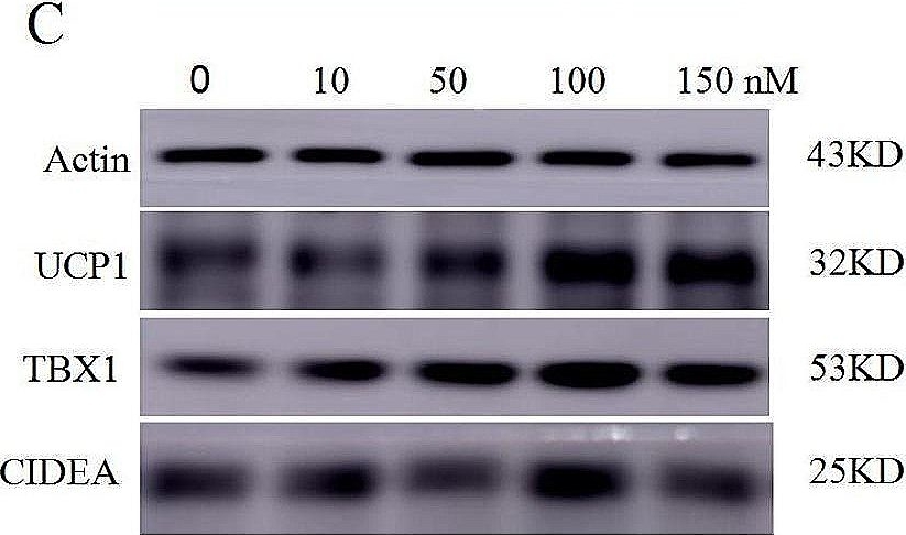 Fig.6.C showing Western Blotting from the publication: Spexin ameliorated obesity-related metabolic disorders through promoting white adipose browning mediated by JAK2-STAT3 pathway.