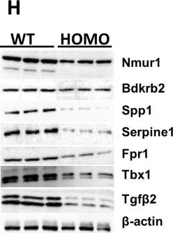 Fig.4.H showing Western Blotting from the publication: Identification of Impacted Pathways and Transcriptomic Markers as Potential Mediators of Pulmonary Fibrosis in Transgenic Mice Expressing Human IGFBP5.