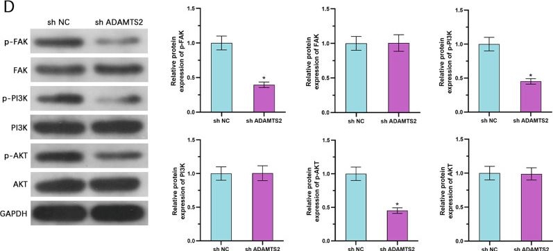 Fig.5.D showing Western Blotting from the publication: ADAMTS2 drives prostate cancer progression by activating FAK/PI3K/AKT signaling and suppressing ferroptosis via COL1A1.