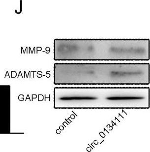 Fig.5.J showing Western Blotting in a Homo sapiens (Human) sample from the publication: Hsa_circ_0134111 promotes intervertebral disc degeneration via sponging miR-578.