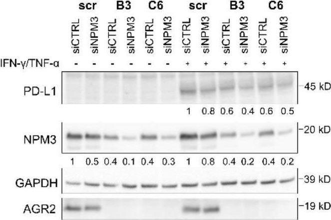 Fig.4.F showing Western Blotting in a Homo sapiens (Human) sample from the publication: Characterization of the AGR2-NPM3 axis uncovers the AGR2 involvement in PD-L1 regulation in colorectal cancer.
