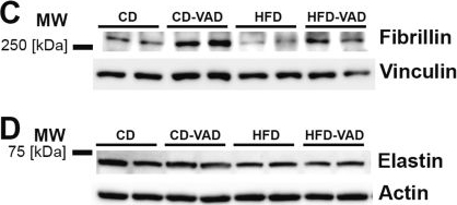 Fig.5.C showing Western Blotting from the publication: Dietary Fat Intake Attenuates Vitamin A Deficiency-Associated Elastic Fiber Remodeling and Lipid Reduction in the Alveolar Niche in Mice.