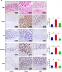 Fig.2.A showing Immunohistochemistry in a Mus musculus (House mouse) sample from the publication: THZ2 Ameliorates Mouse Colitis and Colitis-Associated Colorectal Cancer.