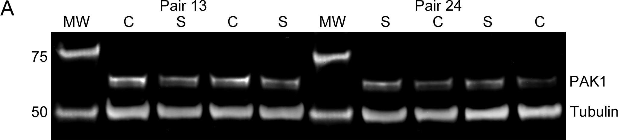 Fig.1.A showing Western Blotting from the publication: PAK1 protein expression in the auditory cortex of schizophrenia subjects.