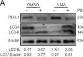 Fig.6.A showing Western Blotting from the publication: Huaier Polysaccharides Sensitize Anti-PD-L1 Therapy via Promoting Antitumor Immune Response in Triple-Negative Breast Cancer.