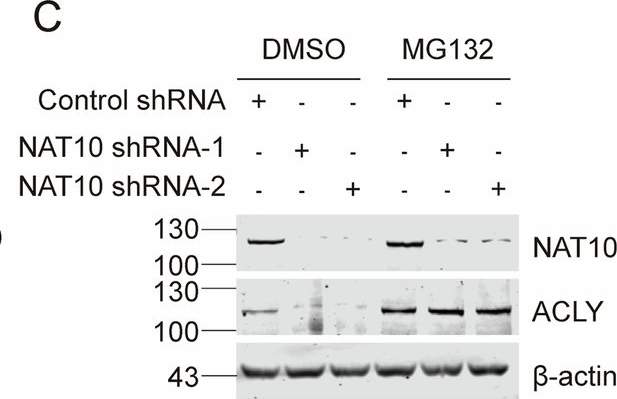 Fig.4.C showing Western Blotting from the publication: Chemotherapy-induced acetylation of ACLY by NAT10 promotes its nuclear accumulation and acetyl-CoA production to drive chemoresistance in hepatocellular carcinoma.