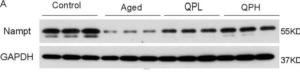 Fig.8.A showing Western Blotting from the publication: Multi-omics reveals mechanism of Qi-Po-Sheng-Mai granule in reducing atrial fibrillation susceptibility in aged rats.