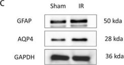 ひとん AQP4 (D1F8E) Rabbit Monoclonal Antibody | Cell Signaling Technology
