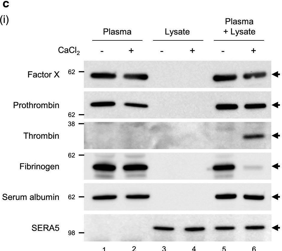 Fig.5.C showing Western Blotting from the publication: The malaria parasite Plasmodium falciparum in red blood cells selectively takes up serum proteins that affect host pathogenicity.