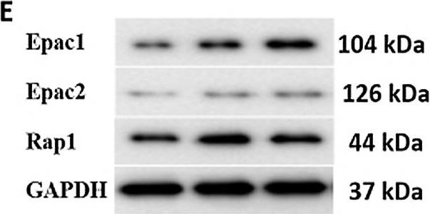 Fig.2.E showing Western Blotting from the publication: cAMP-Epac1 signaling is activated in DDAVP-induced endolymphatic hydrops of guinea pigs.