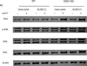 Fig.3.E showing Western Blotting in a Homo sapiens (Human) sample from the publication: CD31 regulates metabolic switch in Treg migration attenuates rheumatoid arthritis.