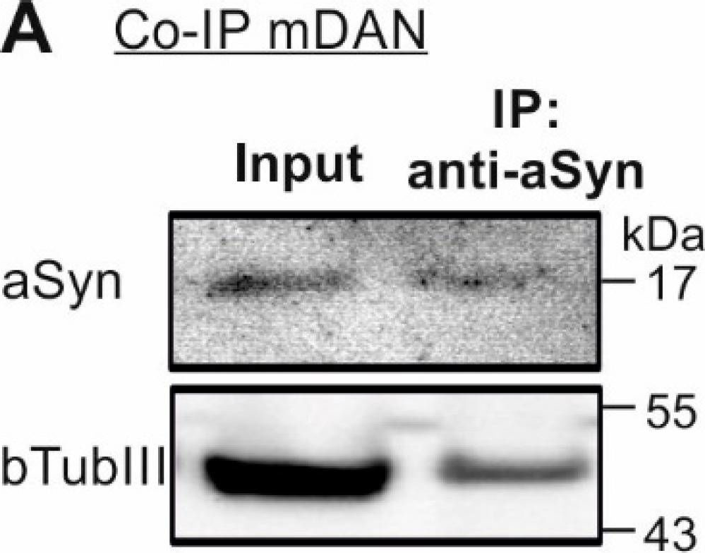 Fig.5.A showing Western Blotting in a Homo sapiens (Human) sample from the publication: Interaction of Alpha Synuclein and Microtubule Organization Is Linked to Impaired Neuritic Integrity in Parkinson's Patient-Derived Neuronal Cells.