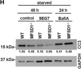 Fig.5.H showing Western Blotting from the publication: The Solute Carrier MFSD1 Decreases the Activation Status of β1 Integrin and Thus Tumor Metastasis.