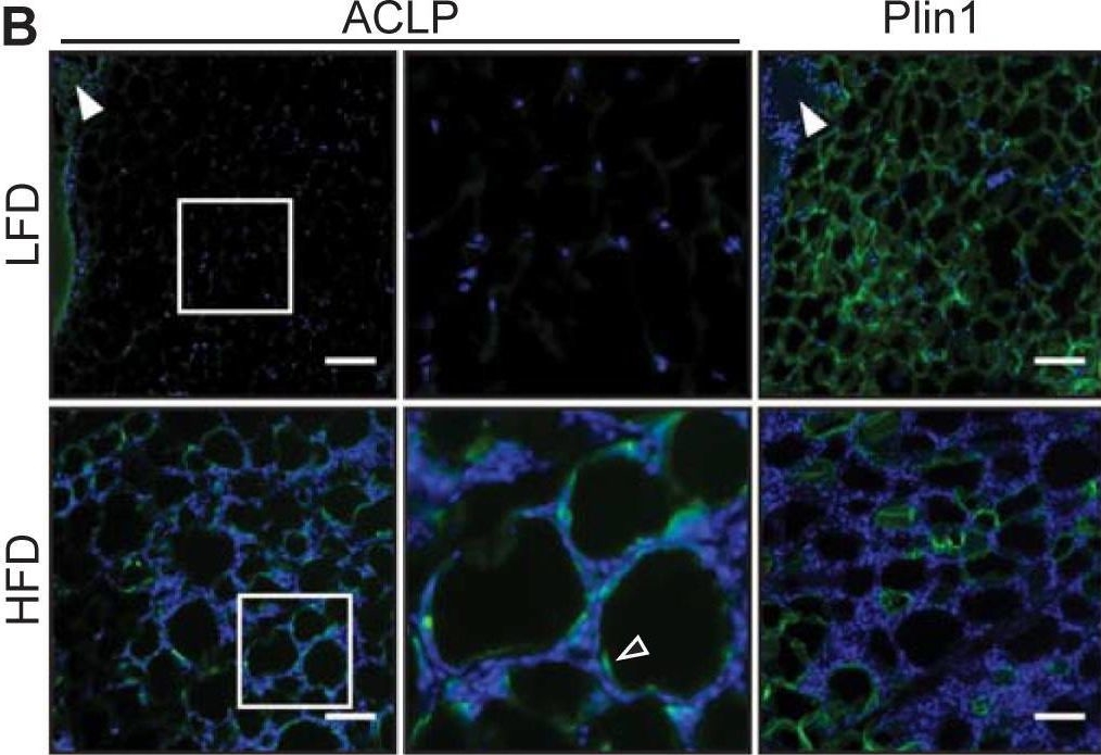 Fig.4.B showing Immunohistochemistry-immunofluorescence in a Mus musculus (House mouse) sample from the publication: Aortic carboxypeptidase-like protein enhances adipose tissue stromal progenitor differentiation into myofibroblasts and is upregulated in fibrotic white adipose tissue.