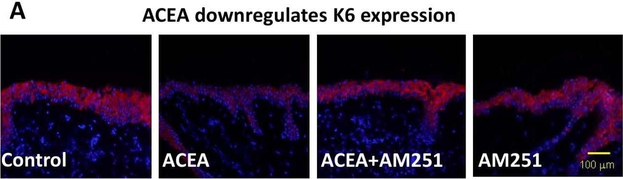 A novel control of human keratin expression: cannabinoid receptor 1-mediated signaling down-regulates the expression of keratins K6 and K16 in human keratinocytes in vitro and in situ.