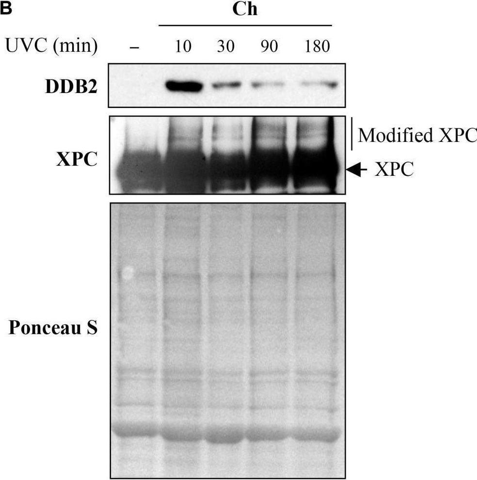 Fig.5.B showing Western Blotting from the publication: Methods to Study Intracellular Movement and Localization of the Nucleotide Excision Repair Proteins at the DNA Lesions in Mammalian Cells.