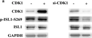 Fig.3.A showing Western Blotting from the publication: Phosphorylation of islet-1 serine 269 by CDK1 increases its transcriptional activity and promotes cell proliferation in gastric cancer.