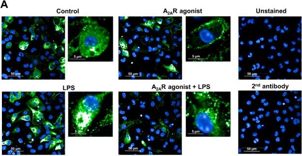 Fig.8.A showing Immunocytochemistry-immunofluorescence from the publication: Adenosine A2A Receptor Activation Regulates Niemann-Pick C1 Expression and Localization in Macrophages.