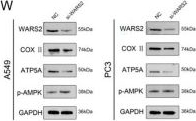 Fig.8.W showing Western Blotting from the publication: Metabolic reprogramming-driven stratification and therapeutic targeting in lung adenocarcinoma: implications for prognosis and personalized treatment.