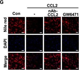 Fig.3.G showing Immunocytochemistry-immunofluorescence from the publication: Cancer Manipulates Adjacent Adipose Tissue to Exploit Fatty Acids via HIF-1α/CCL2/PPARα Axis: A Metabolic Circuit to Support Tumor Progression.