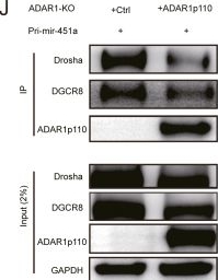 Fig.6.J showing Western Blotting from the publication: ADAR1p110 promotes hepatocellular carcinoma metastasis via the miR-451a/TUBA1A axis.
