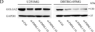 Fig.3.D showing Western Blotting from the publication: Formin-like 1 (FMNL1) Is Associated with Glioblastoma Multiforme Mesenchymal Subtype and Independently Predicts Poor Prognosis.